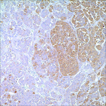 ACTH Rabbit Polyclonal Antibody