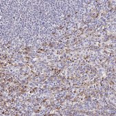 Anti-CYBB antibody produced in rabbit Prestige Antibodies&#174; Powered by Atlas Antibodies, affinity isolated antibody, buffered aqueous glycerol solution