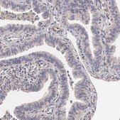 Anti-BMX antibody produced in rabbit Prestige Antibodies&#174; Powered by Atlas Antibodies, affinity isolated antibody, buffered aqueous glycerol solution