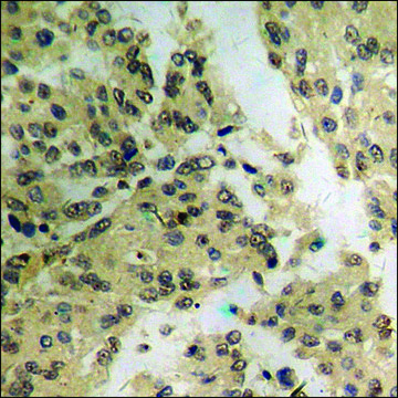 Anti-phospho-MEF2A (pThr319) antibody produced in rabbit affinity isolated antibody