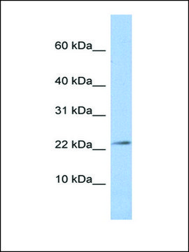 Anti-JAM3 antibody produced in rabbit affinity isolated antibody