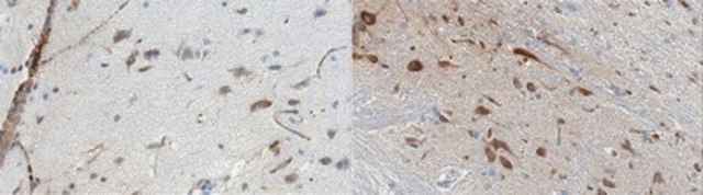 Anti-Serotonin Receptor 1B Antibody, clone 1C2.1 clone 1C2.1, from mouse