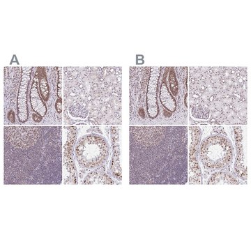 Anti-PTPN2 antibody produced in rabbit Prestige Antibodies&#174; Powered by Atlas Antibodies, affinity isolated antibody, buffered aqueous glycerol solution