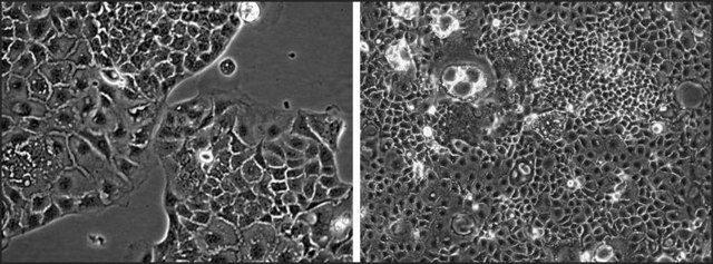 MRP5 Knockout Caco-2 Cells one vial