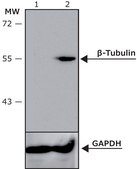 Anti-&#946;-Tubulin III antibody produced in rabbit affinity isolated antibody, buffered aqueous solution