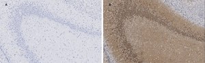 Anti-GluR2 Antibody, clone 1K4, ZooMAb&#174; Rabbit Monoclonal recombinant, expressed in HEK 293 cells