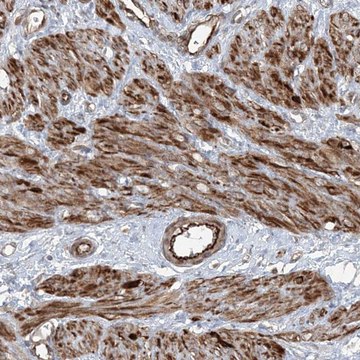 Anti-FBXL17 antibody produced in rabbit Prestige Antibodies&#174; Powered by Atlas Antibodies, affinity isolated antibody, buffered aqueous glycerol solution