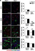 Anti-NG2 Chondroitin Sulfate Proteoglycan Antibody Chemicon&#174;, from rabbit