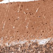 Monoclonal Anti-PTEN antibody produced in mouse Prestige Antibodies&#174; Powered by Atlas Antibodies, clone CL11722, purified immunoglobulin, buffered aqueous glycerol solution