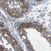 Anti-STIM1 antibody produced in rabbit Prestige Antibodies&#174; Powered by Atlas Antibodies, affinity isolated antibody, buffered aqueous glycerol solution