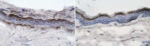 Anti-Collagen Type VII Antibody, clone NP32 ZooMAb&#174; Mouse Monoclonal recombinant, expressed in HEK 293 cells