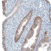 Monoclonal Anti-EPCAM antibody produced in mouse Prestige Antibodies&#174; Powered by Atlas Antibodies, clone CL6313, purified immunoglobulin, buffered aqueous glycerol solution