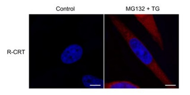 Anti-Calreticulin Antibody, arginylated (Nt-Glu18) from rabbit, purified by affinity chromatography