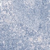Anti-CFTR antibody produced in rabbit Prestige Antibodies&#174; Powered by Atlas Antibodies, affinity isolated antibody, buffered aqueous glycerol solution