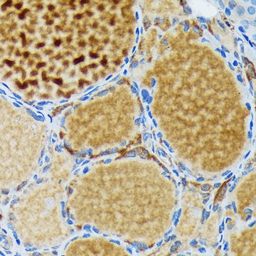 Anti-Thyroid Peroxidase Antibody, clone 3C4A4, Rabbit Monoclonal