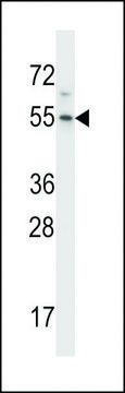 ANTI-HM13(C-TERMINAL) antibody produced in rabbit affinity isolated antibody, buffered aqueous solution