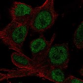 Anti-HOXD4 antibody produced in rabbit Prestige Antibodies&#174; Powered by Atlas Antibodies, affinity isolated antibody, buffered aqueous glycerol solution