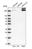 Anti-CIC antibody produced in rabbit Prestige Antibodies&#174; Powered by Atlas Antibodies, affinity isolated antibody, buffered aqueous glycerol solution