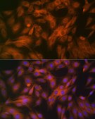 Anti-Calpain 1 Antibody, clone 10E6O5, Rabbit Monoclonal
