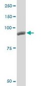 Monoclonal Anti-PYGM antibody produced in mouse clone 2C4, purified immunoglobulin, buffered aqueous solution