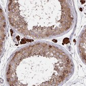 Anti-ACACA antibody produced in rabbit Prestige Antibodies&#174; Powered by Atlas Antibodies, affinity isolated antibody, buffered aqueous glycerol solution