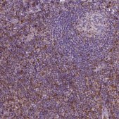 Monoclonal Anti-S100A4 antibody produced in mouse Prestige Antibodies&#174; Powered by Atlas Antibodies, clone CL0237, purified immunoglobulin, buffered aqueous glycerol solution