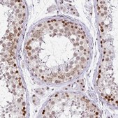 Anti-PTPN2 antibody produced in rabbit Prestige Antibodies&#174; Powered by Atlas Antibodies, affinity isolated antibody, buffered aqueous glycerol solution