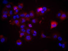 UM-SCC-105 Human Squamous Carcinoma Cell Line