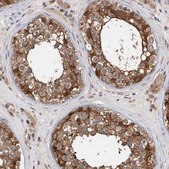 Anti-PDXK antibody produced in rabbit Prestige Antibodies&#174; Powered by Atlas Antibodies, affinity isolated antibody, buffered aqueous glycerol solution