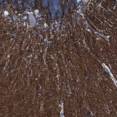 Anti-IGSF8 antibody produced in rabbit Prestige Antibodies&#174; Powered by Atlas Antibodies, affinity isolated antibody, buffered aqueous glycerol solution