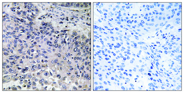 Anti-C1QC antibody produced in rabbit affinity isolated antibody