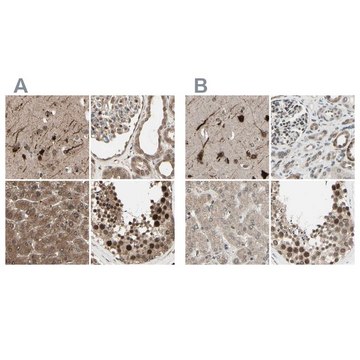 Anti-MLF2 antibody produced in rabbit Ab1, Prestige Antibodies® Powered by Atlas Antibodies, affinity isolated antibody, buffered aqueous glycerol solution