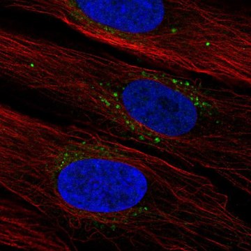 Anti-SYNDIG1 antibody produced in rabbit Prestige Antibodies&#174; Powered by Atlas Antibodies, affinity isolated antibody