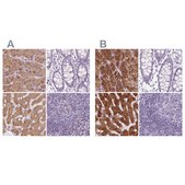 Anti-EPHX1 antibody produced in rabbit Prestige Antibodies&#174; Powered by Atlas Antibodies, affinity isolated antibody, buffered aqueous glycerol solution