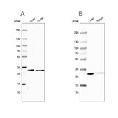 Anti-CA3 antibody produced in rabbit Prestige Antibodies&#174; Powered by Atlas Antibodies, affinity isolated antibody, buffered aqueous glycerol solution, Ab2
