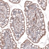 Anti-TMEM2 antibody produced in rabbit Prestige Antibodies&#174; Powered by Atlas Antibodies, affinity isolated antibody, buffered aqueous glycerol solution