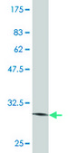 Monoclonal Anti-SLITL2 antibody produced in mouse clone 4G7, purified immunoglobulin, buffered aqueous solution