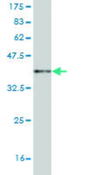 Monoclonal Anti-OPHN1 antibody produced in mouse clone 2B9, purified immunoglobulin, buffered aqueous solution