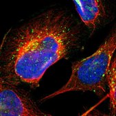 Anti-RRAGA antibody produced in rabbit Prestige Antibodies&#174; Powered by Atlas Antibodies, affinity isolated antibody, buffered aqueous glycerol solution