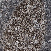 Anti-TERF2IP antibody produced in rabbit Prestige Antibodies&#174; Powered by Atlas Antibodies, affinity isolated antibody, buffered aqueous glycerol solution