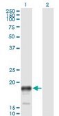 Monoclonal Anti-PSCA antibody produced in mouse clone 1E1, purified immunoglobulin, buffered aqueous solution