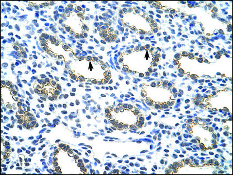 Anti-KRT18 (AB2) antibody produced in rabbit IgG fraction of antiserum