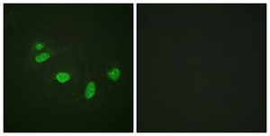 Anti-phospho-ETS1 (pThr38) antibody produced in rabbit affinity isolated antibody
