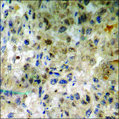 Anti-phospho-Synuclein-&#945; (pTyr136) antibody produced in rabbit affinity isolated antibody