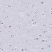 Anti-CDA antibody produced in rabbit Prestige Antibodies&#174; Powered by Atlas Antibodies, affinity isolated antibody, buffered aqueous glycerol solution