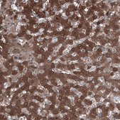 Anti-ALDH1A1 antibody produced in rabbit Prestige Antibodies&#174; Powered by Atlas Antibodies, affinity isolated antibody, buffered aqueous glycerol solution