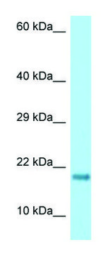 Anti-RPS17 antibody produced in rabbit affinity isolated antibody