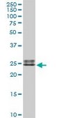 Anti-IGLL1 antibody produced in rabbit purified immunoglobulin, buffered aqueous solution
