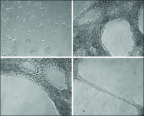 Collagen from Engelbreth-Holm-Swarm murine sarcoma basement membrane Type IV (Miller), lyophilized powder, BioReagent, suitable for cell culture