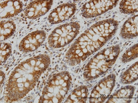 Monoclonal Anti-NDUFS4 antibody produced in mouse clone 1A1, purified immunoglobulin, buffered aqueous solution